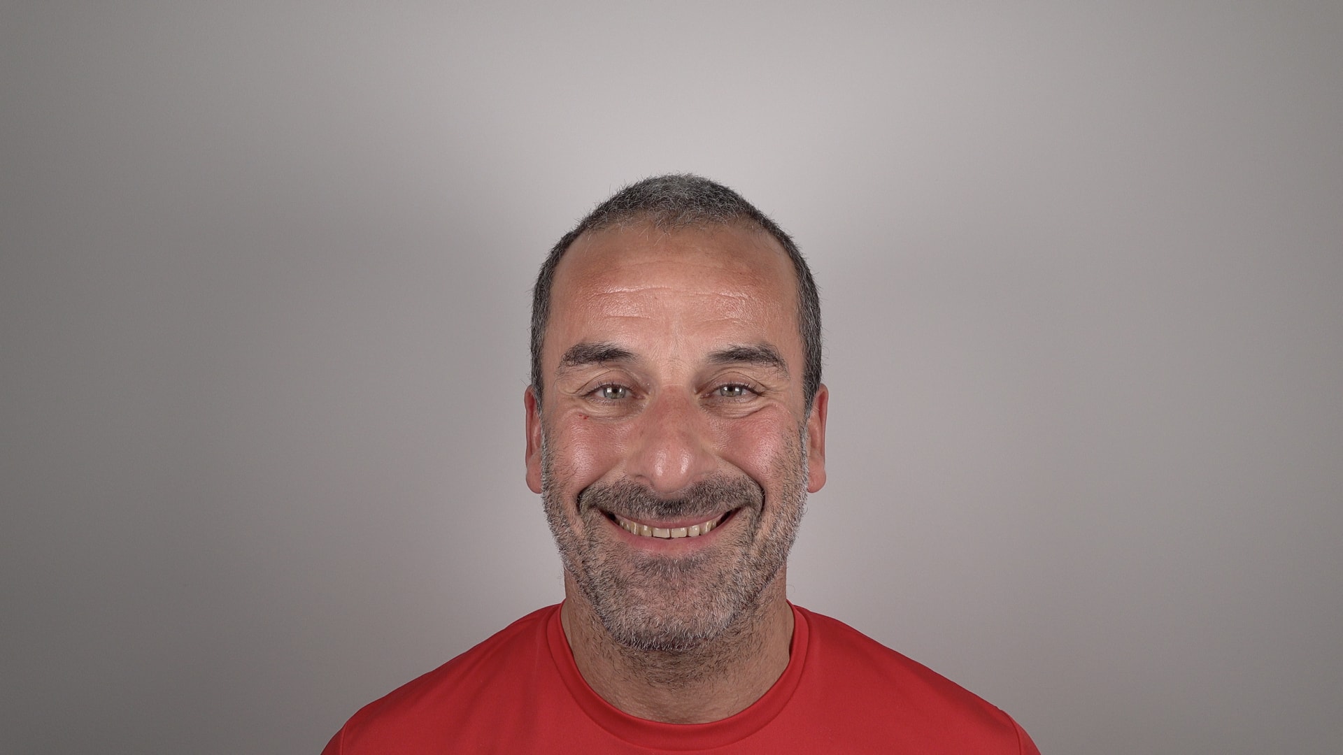 Antonio Díaz Ortega. Invisalign, Veneers and Dental Crowns 1 Before