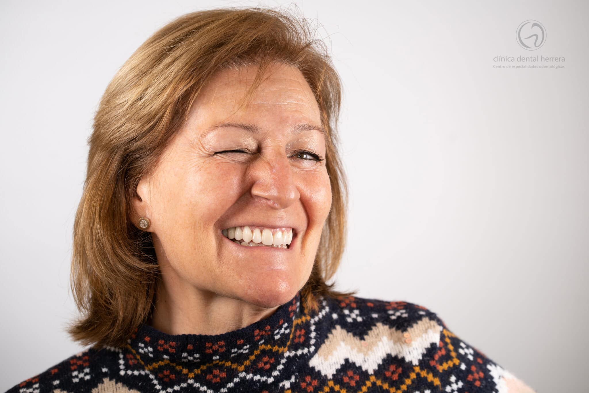 Inmaculada García-Chicano. Orthodontics, Implants and Dental Veneers 2 After